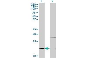 Western Blotting (WB) image for anti-Parathyroid Hormone (PTH) antibody (ABIN793030) (PTH 抗体)