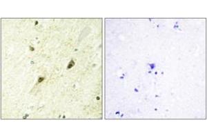 Immunohistochemistry analysis of paraffin-embedded human brain tissue, using GLI-3 Antibody. (GLI3 抗体  (AA 11-60))