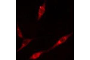 ABIN6276587 staining  A549 cells by IF/ICC. (PML 抗体  (N-Term))