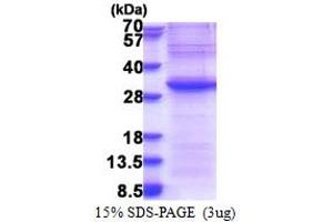EXOSC4 Protein (AA 1-245) (His tag)