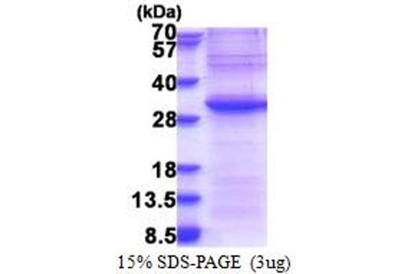 EXOSC4 Protein (AA 1-245) (His tag)