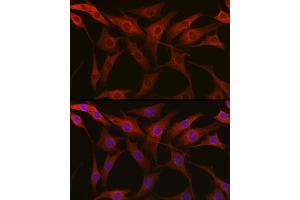 Immunofluorescence analysis of NIH-3T3 cells using β-Tubulin Rabbit pAb (ABIN3020552, ABIN3020553 and ABIN3020554) at dilution of 1:100 (40x lens).