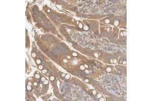 Immunohistochemical staining of human small intestine with FAM167A polyclonal antibody  shows moderate cytoplasmic positivity in glandular cells. (FAM167A 抗体)