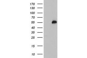 Western Blotting (WB) image for anti-Tubby Like Protein 3 (TULP3) antibody (ABIN1501586) (TULP3 抗体)
