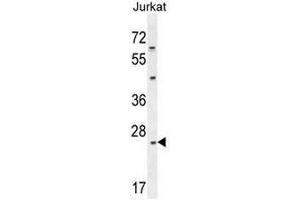 CLDN22 Antibody (Center) western blot analysis in Jurkat cell line lysates (35µg/lane). (Claudin 22 (CLDN22) (AA 97-126), (Middle Region) 抗体)