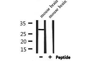 Western blot analysis of extracts from rat heart and mouse brain, using NOL7 Antibody. (NOL7 抗体  (C-Term))