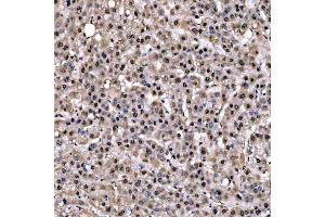 IHC analysis of SNRPD2 using anti-SNRPD2 antibody (ABIN7598963).