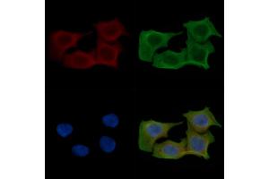 ABIN6257650 and ABIN6275616 staining Hela cells(45 min of heat-shock) by IF/ICC. (SYT11 抗体  (Internal Region))