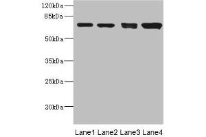 Western blot All lanes: LINGO antibody at 3. (LINGO1 抗体  (AA 42-240))