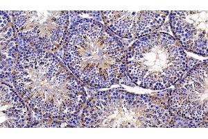 Immunohistochemistry (IHC) image for anti-Macrophage Migration Inhibitory Factor (Glycosylation-Inhibiting Factor) (MIF) (AA 3-111) antibody (ABIN7432415)