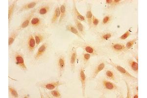 Immunocytochemistry analysis of Hela cells using ABIN7139610 at dilution of 1:100 (HIST1H3A 抗体  (meLys9))