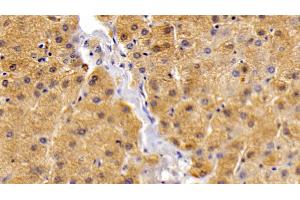 Detection of LEPR in Human Liver Tissue using Polyclonal Antibody to Leptin Receptor (LEPR)
