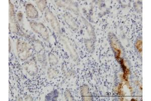 Immunoperoxidase of monoclonal antibody to NUP133 on formalin-fixed paraffin-embedded human stomach. (NUP133 抗体  (AA 1069-1155))