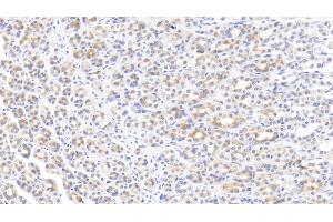 Detection of EGF in Rat Stomach Tissue using Monoclonal Antibody to Epidermal Growth Factor (EGF) (EGF 抗体  (AA 974-1026))