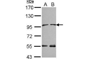 Western Blotting (WB) image for anti-N(alpha)-Acetyltransferase 15, NatA Auxiliary Subunit (NAA15) (C-Term) antibody (ABIN1491819) (NAA15 抗体  (C-Term))