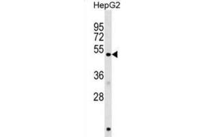 Western Blotting (WB) image for anti-Homocysteine-Inducible, Endoplasmic Reticulum Stress-Inducible, Ubiquitin-Like Domain Member 1 (HERPUD1) antibody (ABIN2999299) (HERPUD1 抗体)