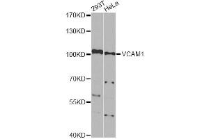 Western blot analysis of extracts of various cell lines, using VCAM1 Antibody. (VCAM1 抗体)