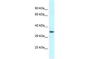 Western Blotting (WB) image for anti-Fibronectin Type III and SPRY Domain Containing 1-Like (FSD1L) (C-Term) antibody (ABIN2788498) (FSD1L 抗体  (C-Term))