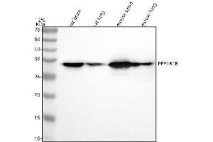 Western blot analysis of PPP1R1B using anti-PPP1R1B antibody (ABIN7604607).