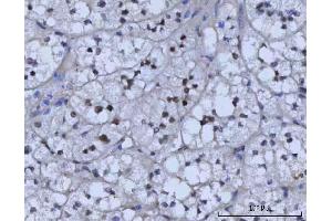 IHC analysis of RAD51C using anti-RAD51C antibody (ABIN7599718).