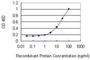 Detection limit for recombinant GST tagged LRRN1 is 0.