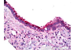 Immunohistochemistry (IHC) image for anti-Prostaglandin E Receptor 1 (Subtype EP1), 42kDa (PTGER1) (AA 380-402) antibody (ABIN2451690)