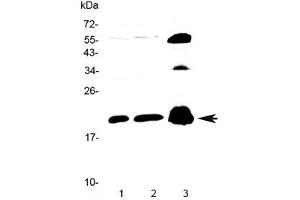 Western blot testing of 1) rat brain, 2) mouse brain and 3) human PANC1 lysate with CPI-17 antibody at 0. (CPI-17 抗体)
