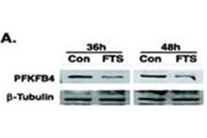 Image no. 2 for anti-6-phosphofructo-2-Kinase/fructose-2,6-Biphosphatase 4 (PFKFB4) (AA 274-303) antibody (ABIN360670) (PFKFB4 抗体  (AA 274-303))