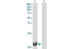 Western Blot analysis of TRIML1 expression in transfected 293T cell line by FLJ36180 monoclonal antibody (M01), clone 4F8. (TRIML1 抗体  (AA 369-468))
