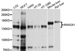 Western blot analysis of extracts of various cell lines, using MAN2A1 antibody. (alpha-Mannosidase II 抗体  (AA 865-1144))