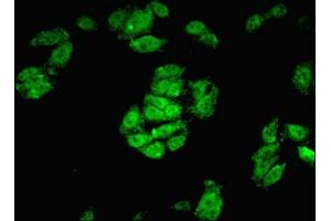 Immunofluorescent analysis of HepG2 cells using ABIN7148820 at dilution of 1:100 and Alexa Fluor 488-congugated AffiniPure Goat Anti-Rabbit IgG(H+L) (CREB3L2 抗体  (AA 1-247))