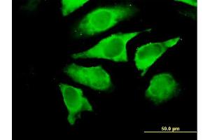 Immunofluorescence of purified MaxPab antibody to UNC119 on HeLa cell. (UNC119 抗体  (AA 1-240))
