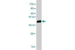 Western Blot detection against Immunogen (36. (ABL2 抗体  (AA 743-842))