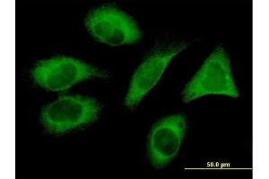 Immunofluorescence of monoclonal antibody to FLJ20643 on HeLa cell. (PIH1D1 抗体  (AA 1-290))