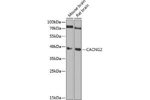 Western Blotting (WB) image for anti-Calcium Channel, Voltage-Dependent, gamma Subunit 2 (CACNG2) (AA 204-323) antibody (ABIN6137826)