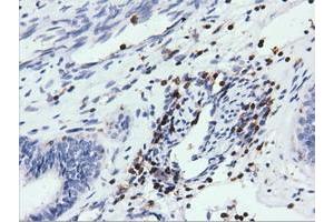 Immunohistochemical staining of paraffin-embedded Human colon tissue using anti-ARHGAP25 mouse monoclonal antibody. (ARHGAP25 抗体)