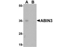 Western blot analysis of ABIN3 in human spleen tissue lysate with AP30005PU-N ABIN3 antibody at 1 μg/ml in (A) the absence and (B) the presence of blocking peptide. (TNIP3 抗体  (C-Term))