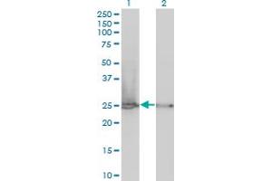 Western Blot analysis of RPL19 expression in transfected 293T cell line by RPL19 monoclonal antibody (M01), clone 3H4. (RPL19 抗体  (AA 1-100))