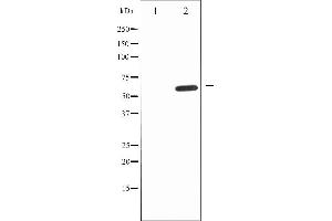 Western blot analysis of IL-10R alpha expression in Na2VO3 treated HepG2 whole cell lysates,The lane on the left is treated with the antigen-specific peptide. (IL-10RA 抗体  (C-Term))