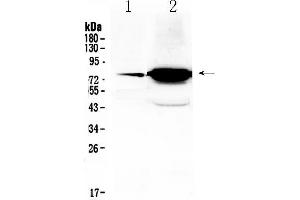 Western Blotting (WB) image for anti-Follicle Stimulating Hormone Receptor (FSHR) (AA 414-438), (Middle Region) antibody (ABIN5518834)