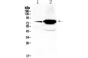 Western blot analysis of FSH Receptor using anti- FSH Receptor antibody . (FSHR 抗体  (Middle Region))
