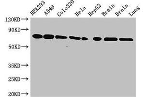 Western Blot Positive WB detected in: HEK293 whole cell lysate, A549 whole cell lysate, Colo320 whole cell lysate, Hela whole cell lysate, HepG2 whole cell lysate, Mouse brain tissue, Rat brain tissue, Rat lung tissue All lanes: HSPA8 antibody at 3. (Hsc70 抗体  (AA 418-597))