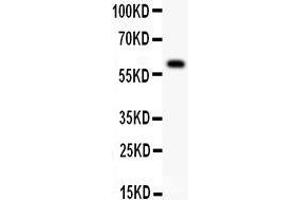 Anti- DR3 antibody, Western blotting All lanes: Anti DR3  at 0. (DR3/LARD 抗体  (N-Term))