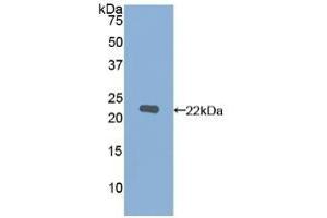 Detection of Recombinant MMP12, Human using Polyclonal Antibody to Matrix Metalloproteinase 12 (MMP12) (MMP12 抗体  (AA 290-469))