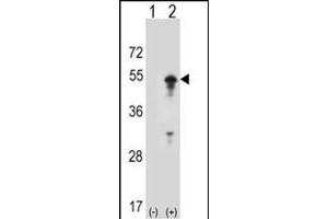 Western blot analysis of ST (arrow) using rabbit polyclonal ST Antibody (D10) (ABIN1882134 and ABIN2839215). (STAM 抗体  (N-Term))