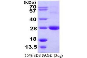 SDS-PAGE (SDS) image for ADP-Ribosylation Factor-Like 11 (ARL11) (AA 1-196) protein (His tag) (ABIN667499) (ARL11 Protein (AA 1-196) (His tag))