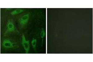Immunofluorescence (IF) image for anti-Aquaporin 2 (Collecting Duct) (AQP2) (AA 222-271) antibody (ABIN2888757) (AQP2 抗体  (AA 222-271))