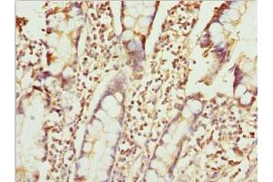 Immunohistochemistry of paraffin-embedded human small intestine tissue using ABIN7176126 at dilution of 1:100 (ZNF169 抗体  (AA 1-85))