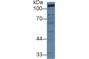 Detection of PC in Porcine Liver lysate using Polyclonal Antibody to Pyruvate Carboxylase (PC) (PC 抗体  (AA 36-486))