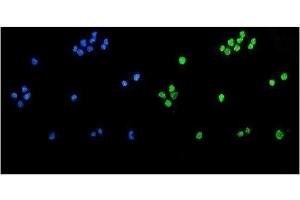 anti-Tet Methylcytosine Dioxygenase 1 (TET1) (AA 194-417) antibody